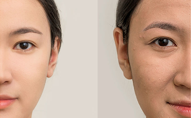 Best Anti-Aging Products Online
