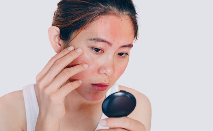 Facial Redness Reducing Products